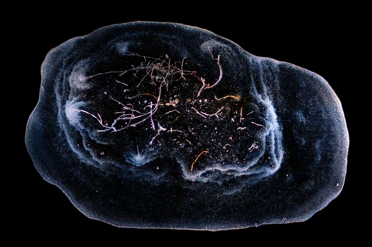 Dark Field Microscopy of washing machine drain with microplastics 