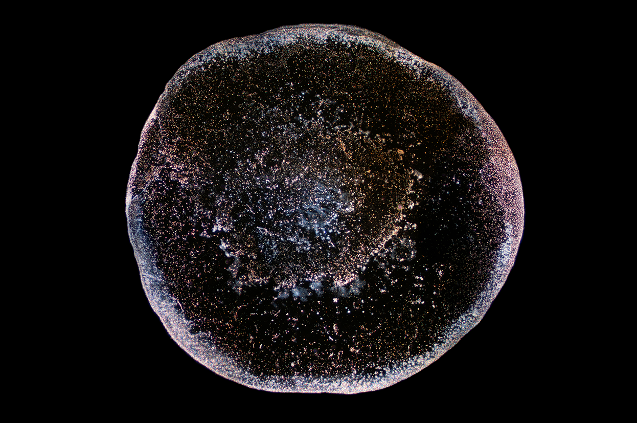 Groundwater Darkfield Microscopy_Groundwater